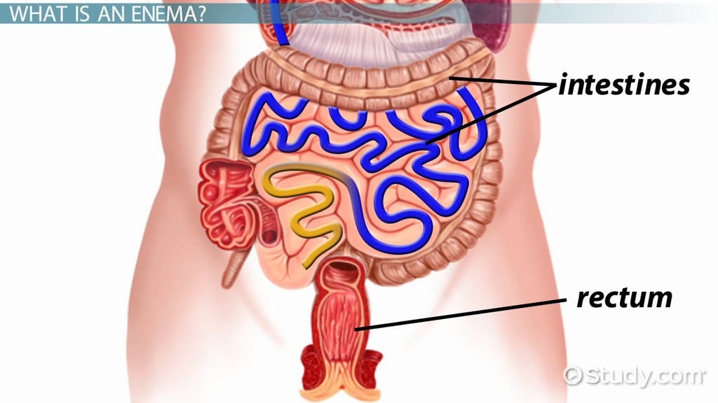 biologi-enema-kopi-untuk-empedu-liver-usus-besar